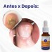 homeopast - FORTALECEDOR DE UNHAS 18ml